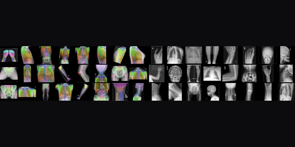 MIT'nin FleXray modeli röntgende 60 anatomik yapıyı ayrı ayrı işaretliyor