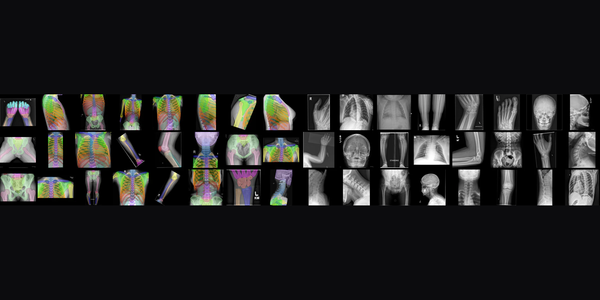 MIT'nin FleXray modeli röntgende 60 anatomik yapıyı ayrı ayrı işaretliyor